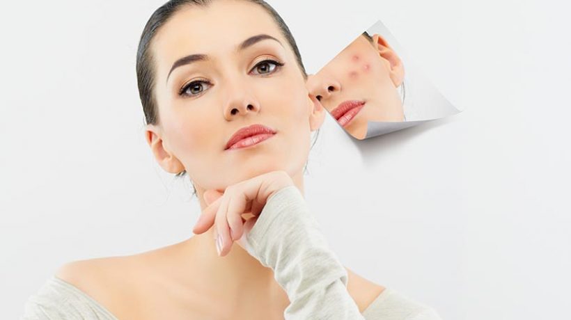 Tips for removing dark spots on the skin