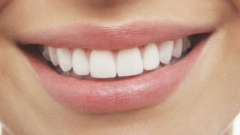 Recommendations for using activated charcoal for teeth whitening