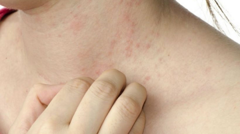 The most common skin diseases