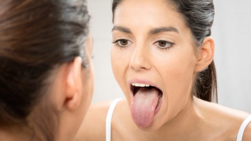 How to Heal a Burnt Tongue and Scalding With Natural Remedies