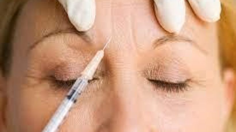 What to Think About and Look into Before Getting Botox or Fillers